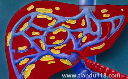 肝代謝不好吃什么調(diào)理4