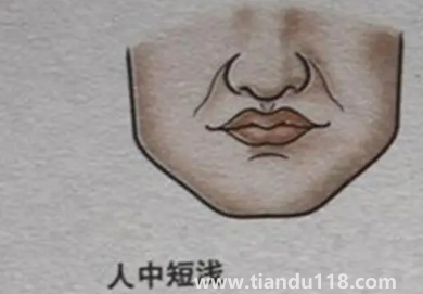 人中上的痣能去掉嗎3