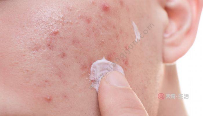 珍珠粉加蛋清敷臉有什么用 珍珠粉加蛋清敷臉的護(hù)膚作用有哪些(圖4) 珍珠粉加蛋清敷臉有什么用